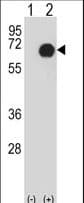 Polyclonal Rabbit anti-Human RET Antibody (WB)