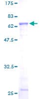 Human ACTR2 / ARP2 Protein (Recombinant GST)