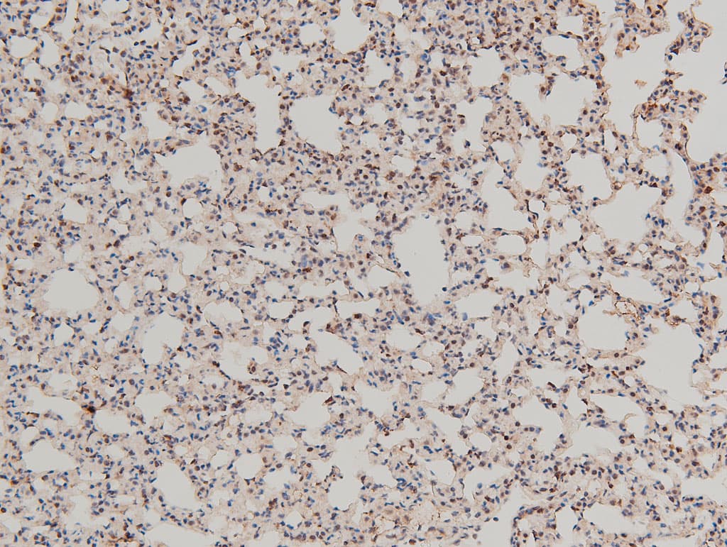 LIMK1 / LIMK Antibody (phospho-Thr508)
