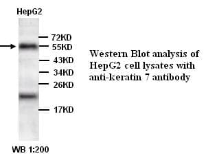 KRT7 / CK7 / Cytokeratin 7 Antibody (C-Terminus)