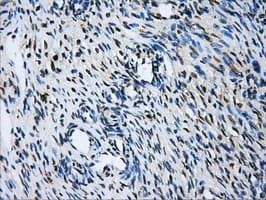 GBE1 Antibody (clone OTI5B7)