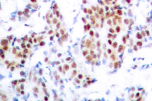 Polyclonal Rabbit anti-Human STAT5 A+B Antibody (Ala688, IHC, WB)