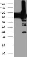 PFKP Antibody (clone OTI2F2, Carrier-free)