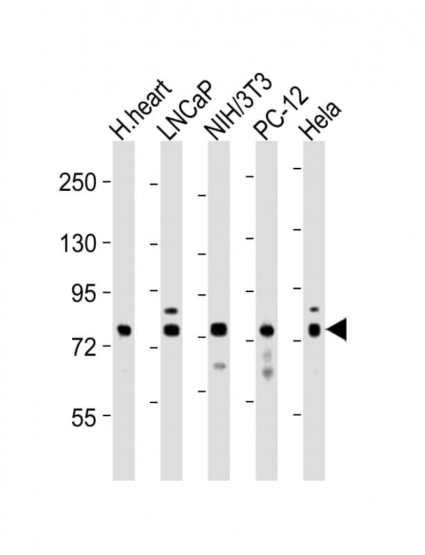 DNM1L / DRP1 Antibody (aa557-590)