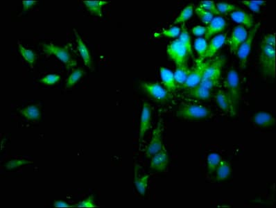 SERPINB1 Antibody (aa1-379)