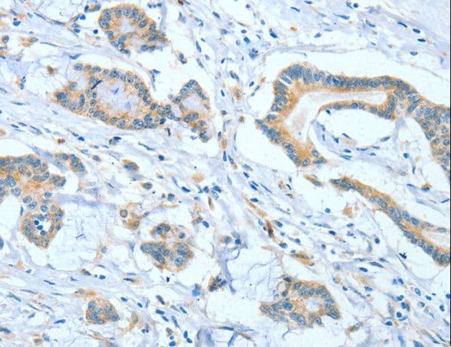 Polyclonal Rabbit anti-Human ASCC1 Antibody (IHC)