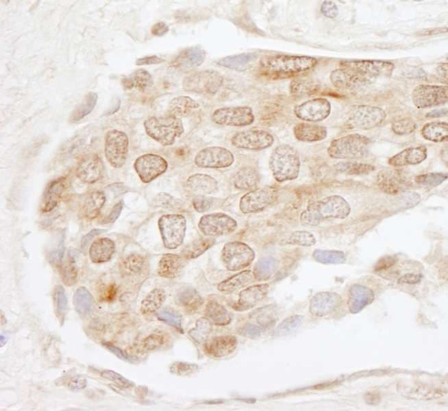Polyclonal Rabbit anti-Human EHMT1 Antibody (aa25-75, IHC, WB)