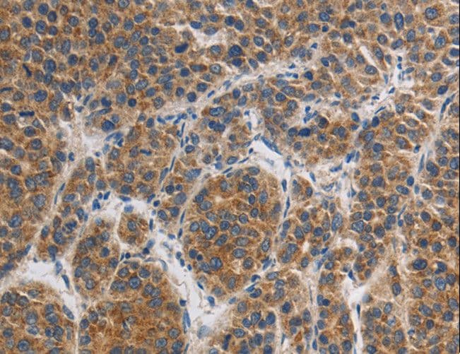 GRIN1 / NMDAR1 Antibody