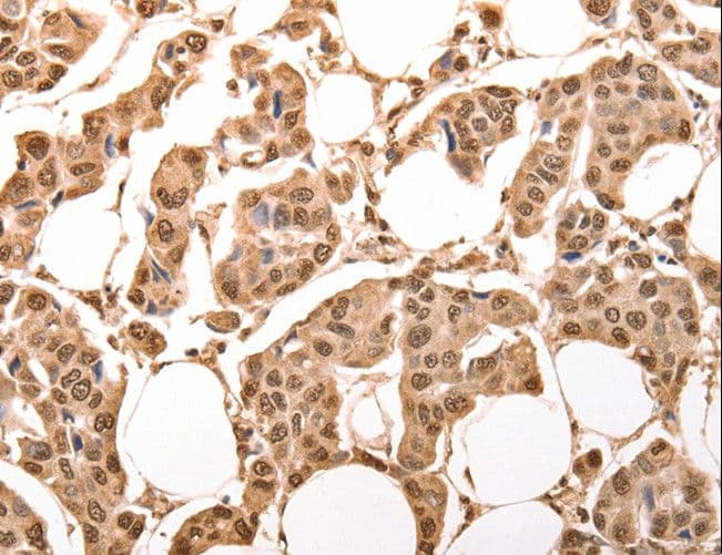 Polyclonal Rabbit anti-Human ACO2 / Aconitase 2 Antibody (IHC, WB)