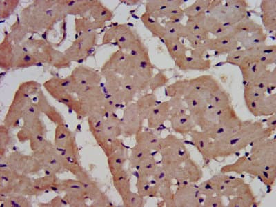 Polyclonal Rabbit anti-Human IL1RAPL1 Antibody (IHC, IF, WB)