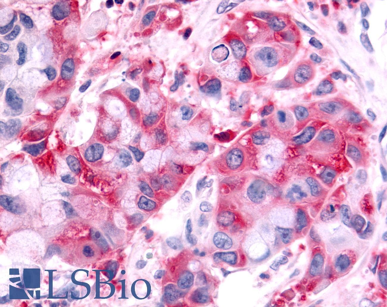 PathPlus™ Polyclonal Rabbit anti-Human HUNK / B19 Antibody (Kinase Domain, IHC)