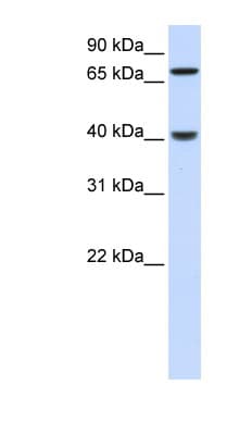 PDLIM3 Antibody (N-Terminus)