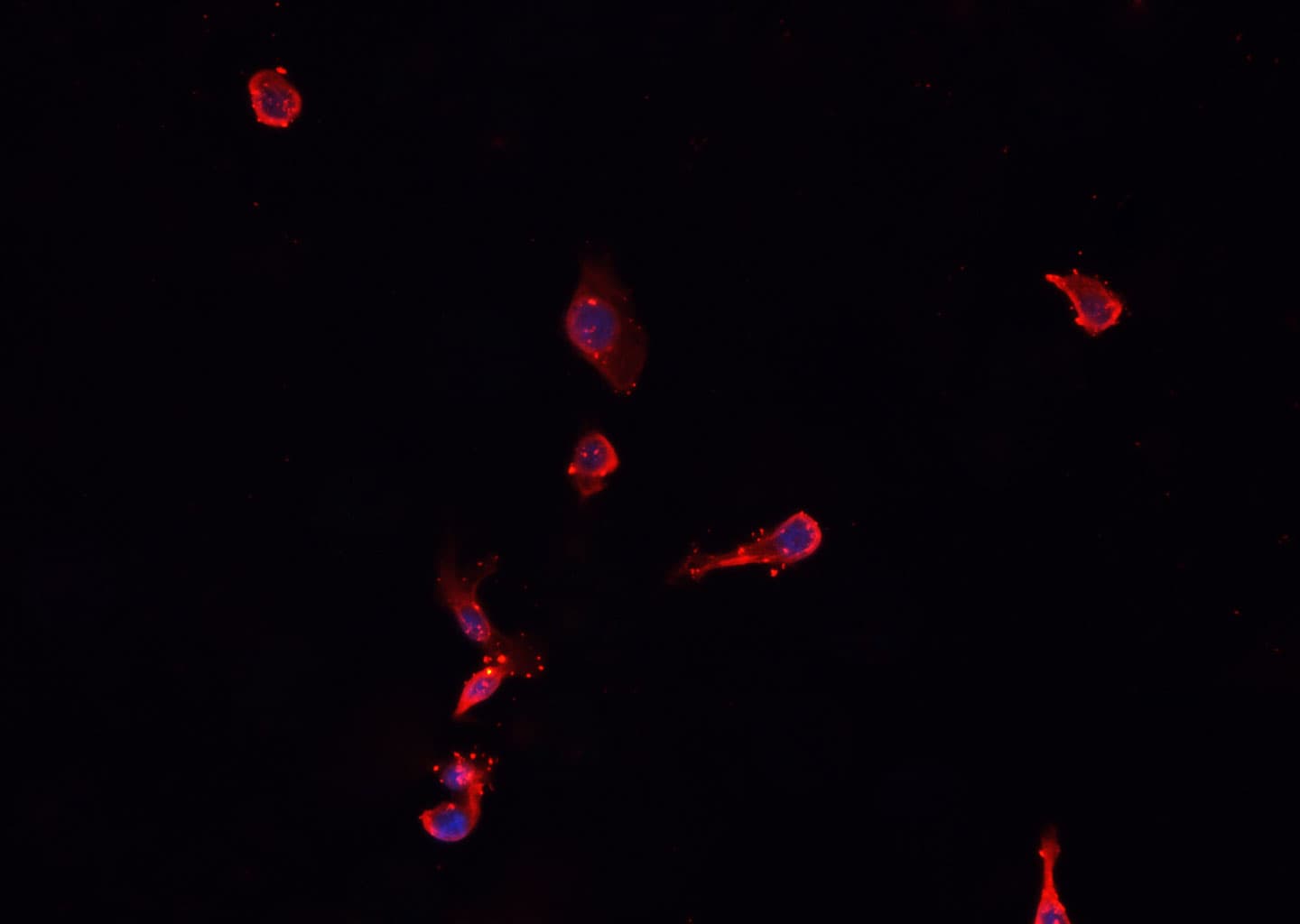 NPPA / ANP Antibody