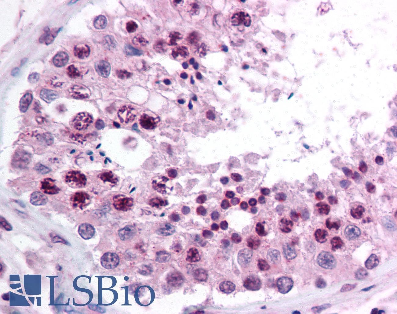 IHC-plus™ Polyclonal Rabbit anti-Human DNMT / DNMT1 Antibody (aa1603-1616, IHC)