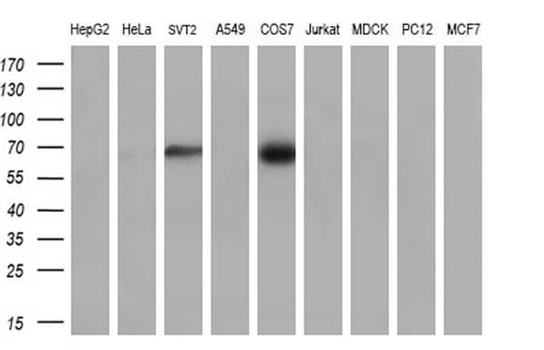 CLU / Clusterin Antibody (aa23-227, clone OTI5D3, Carrier-free)