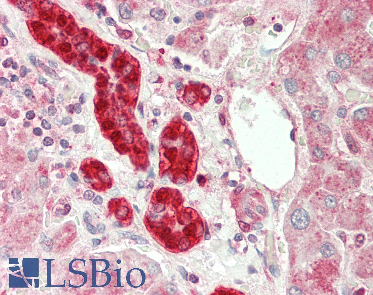 IHC-plus™ Monoclonal Mouse anti-Human GSTP1 / GST Pi Antibody (clone 10H1, IHC, WB)