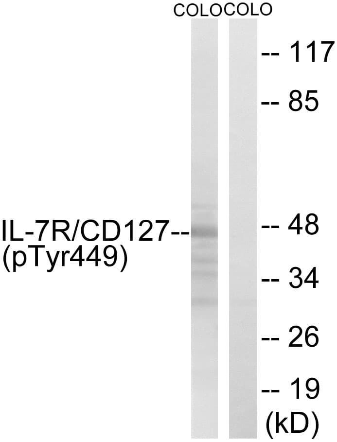 IL7R / CD127 Antibody (phospho-Tyr449)