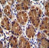 MUC3B Antibody (aa866-895)