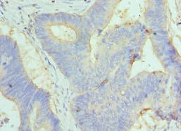 GC / Vitamin D-Binding Protein Antibody (aa305-474)