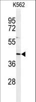 INO80B / PAPA-1 Antibody (aa146-174)