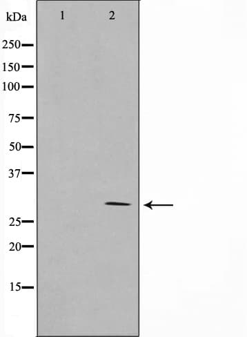 MRRF Antibody