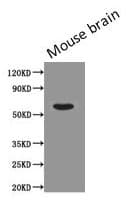PODXL / Podocalyxin Antibody (clone 4D2G7)
