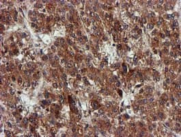 Monoclonal Mouse anti-Human EPM2AIP1 Antibody (clone OTI2A2, IHC, WB)