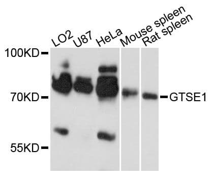 Polyclonal Rabbit anti-Human GTSE1 Antibody (WB)