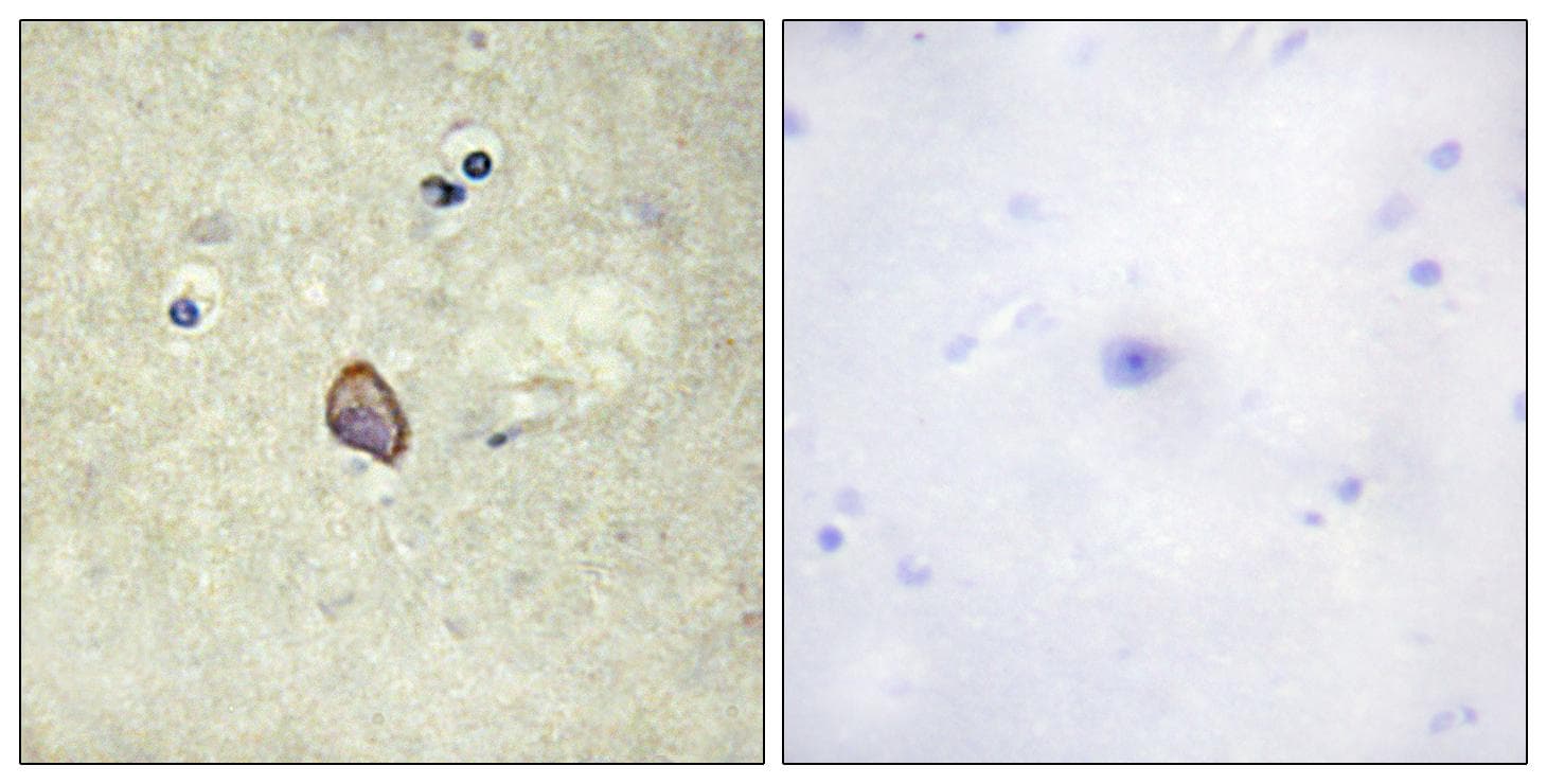 ERBB3 / HER3 Antibody (phospho-Tyr1328)