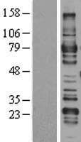 ARHGAP25 Protein (Over-Expression Lysate Myc-DDK (Flag))