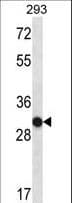 OR4K14 Antibody (aa64-92)