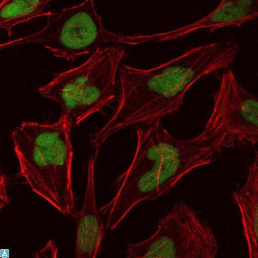 MCM2 Antibody