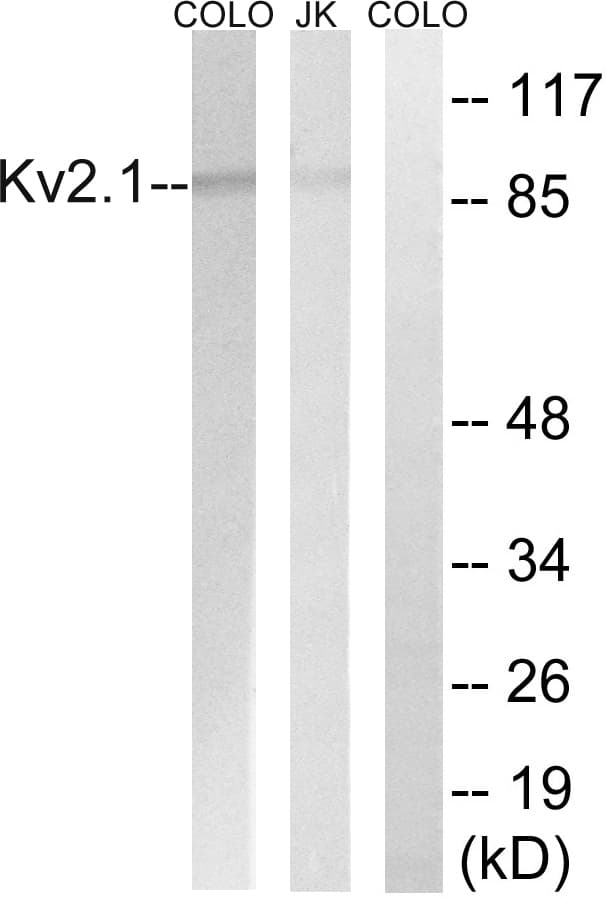 Polyclonal Rabbit anti-Human KCNB1 / Kv2.1 Antibody (WB)