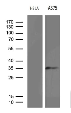 Monoclonal Mouse anti-Human RPAIN Antibody (clone OTI4F7, WB)