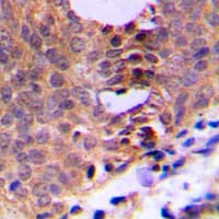 Polyclonal Rabbit anti-Human CDK1 / CDC2 Antibody (phospho-Thr161, IHC, IF, WB)