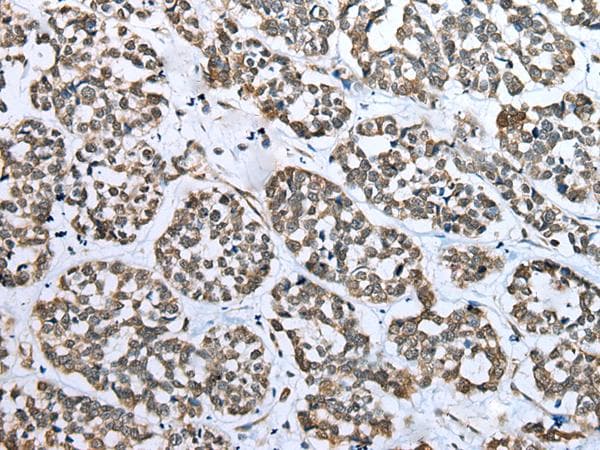 CARTPT / CART Antibody