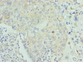 Polyclonal Rabbit anti-Human Lumican Antibody (IHC)