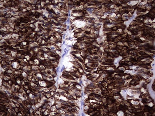 KRT19 / CK19 / Cytokeratin 19 Antibody (aa240-390, clone OTI5G7)