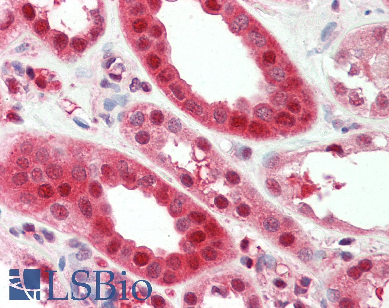 IHC-plus™ SERPINA6 / CBG Antibody (aa197-225)