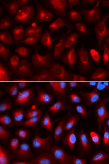 Polyclonal Rabbit anti-Human KLC1 / Kinesin Light Chain 1 Antibody (IHC, IF, WB)
