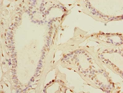 TTC33 Antibody