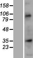 NUP35 / NUP53 Protein (Over-Expression Lysate Myc-DDK (Flag))