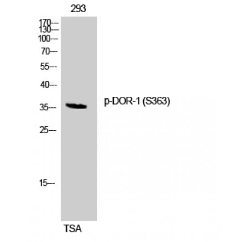 OPRD1 / Delta Opioid Receptor Antibody (300-380 aa)