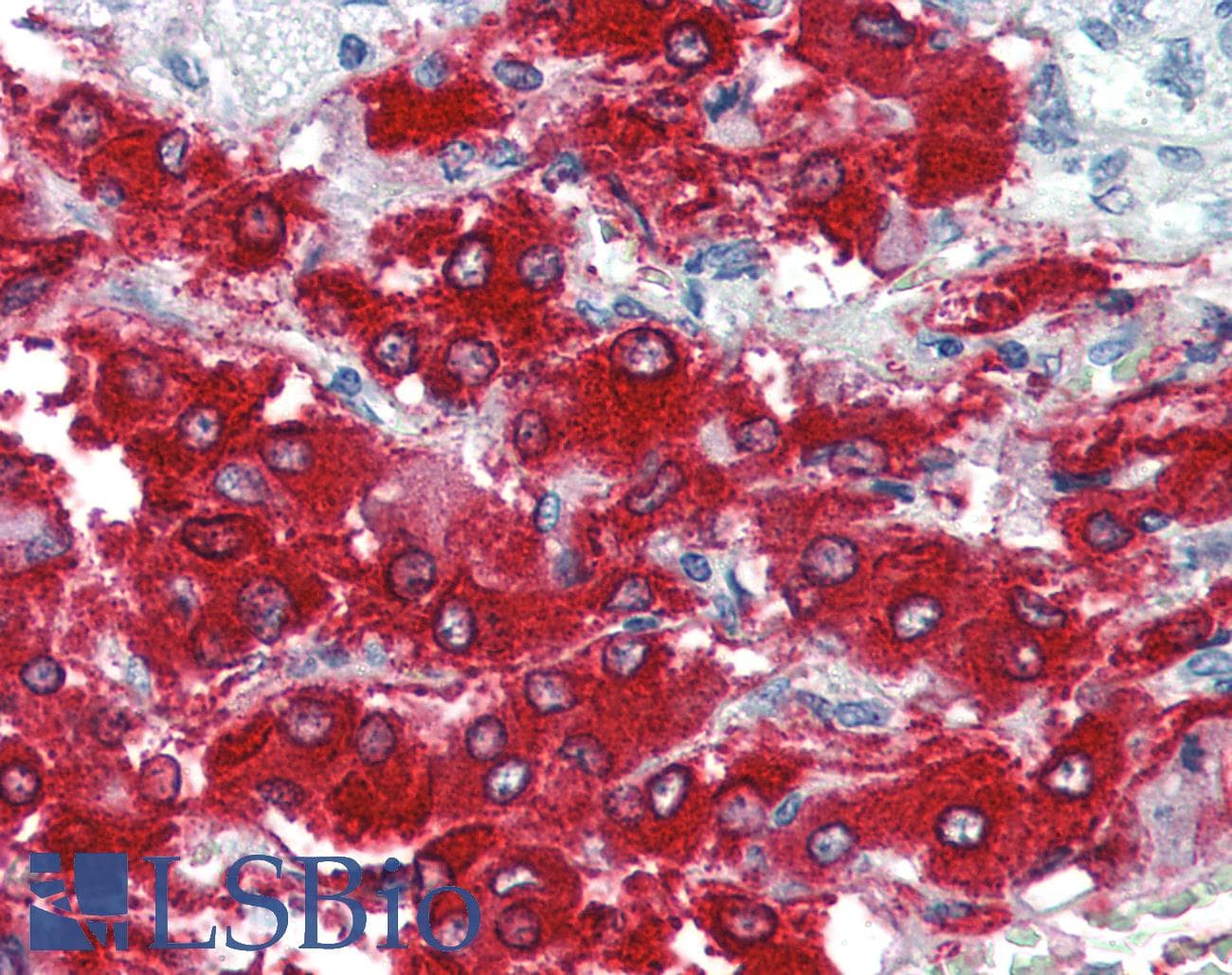PathPlus™ TH / Tyrosine Hydroxylase Antibody (phospho-Ser40)
