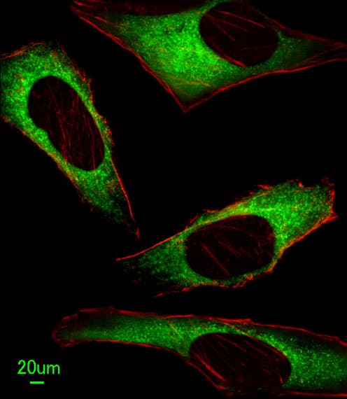 ITPA Antibody (aa24-51)