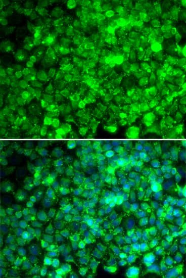 IHC-plus™ ADIPOR1/Adiponectin Receptor 1 Antibody