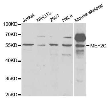 Polyclonal Rabbit anti-Human MEF2C Antibody (IHC, WB)