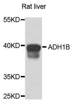 ADH2 / ADH1B Antibody