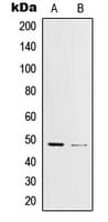 JUN / c-Jun Antibody (phospho-Tyr170)