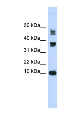 PathPlus™ Polyclonal Rabbit anti-Human FABP3 / H-FABP Antibody (aa36-85, IHC, WB)